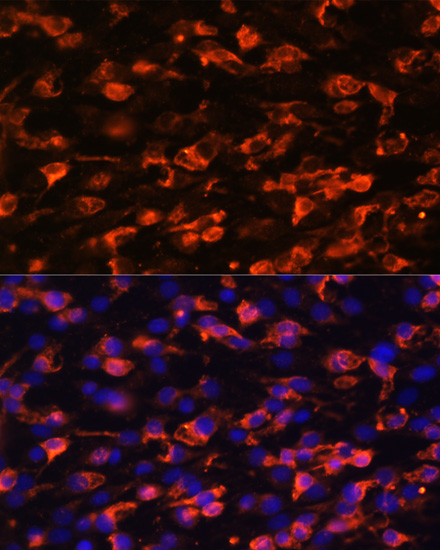 Anti-PIK3C2A Rabbit pAb