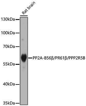 Anti-PP2A-PPP2R5B Rabbit pAb