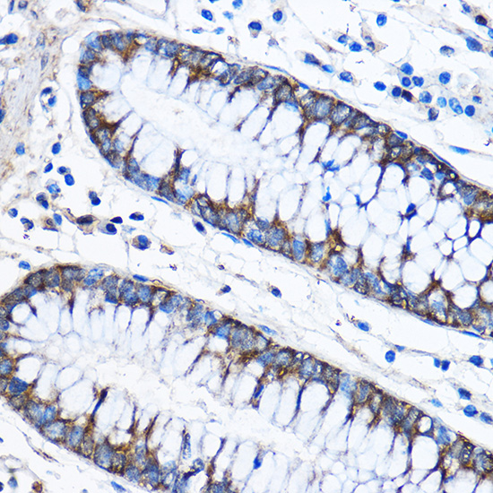 Anti-CAPZA2 Rabbit pAb