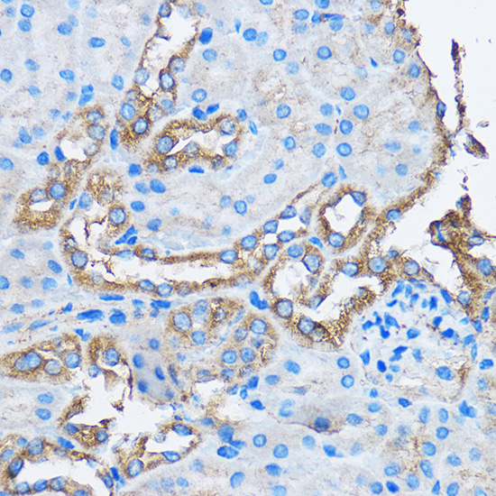 Anti-CAPZA2 Rabbit pAb