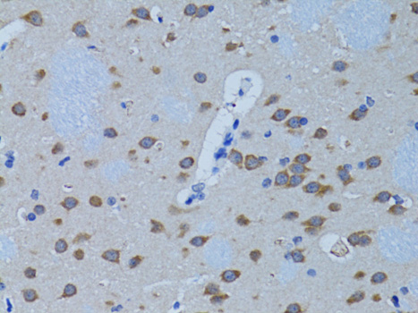 Anti-PLCB1 Rabbit pAb
