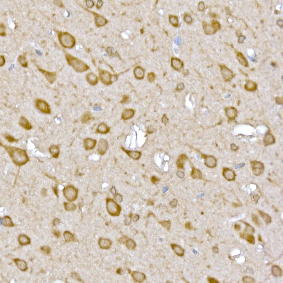 Anti-CASTOR1 Rabbit pAb