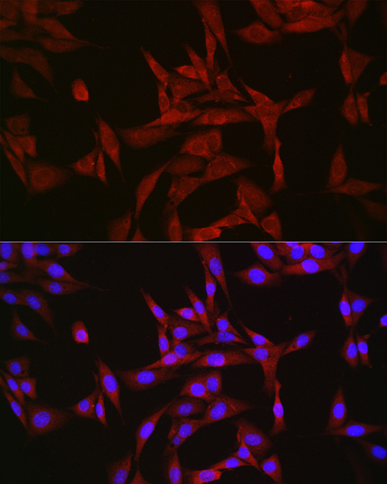 Anti-CASTOR1 Rabbit pAb