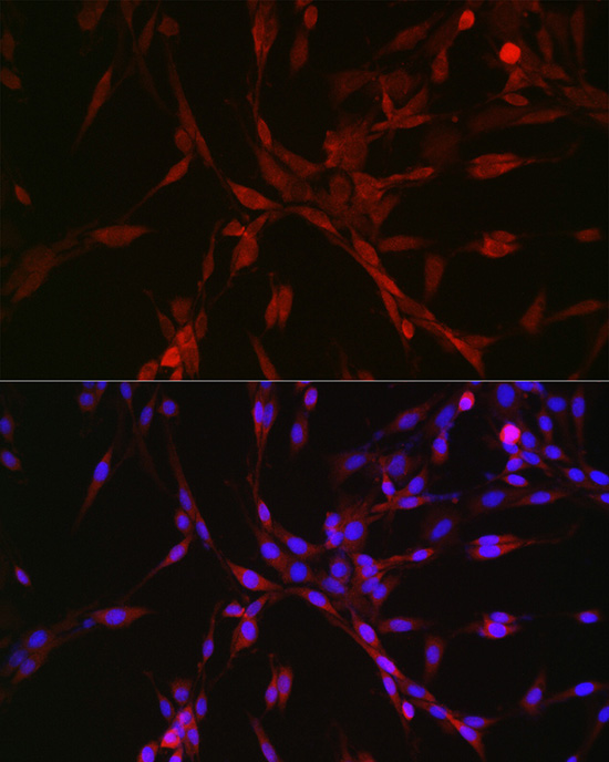 Anti-CASTOR1 Rabbit pAb