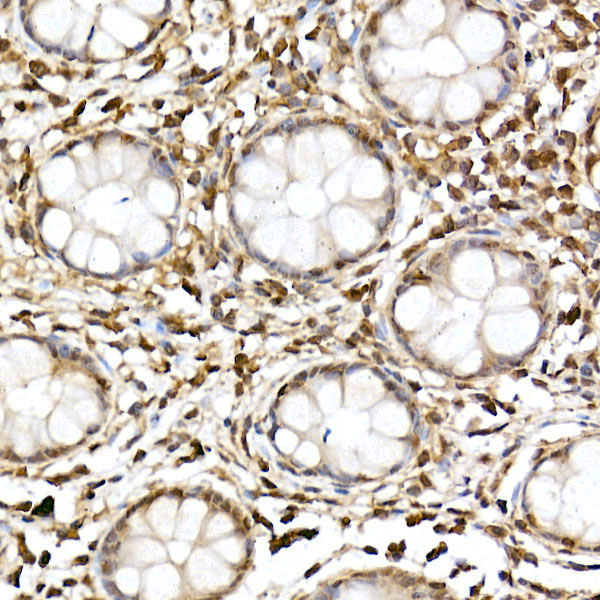 Anti-JNK1/2/3 Rabbit pAb