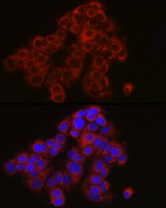 Anti-TYK2 Rabbit pAb