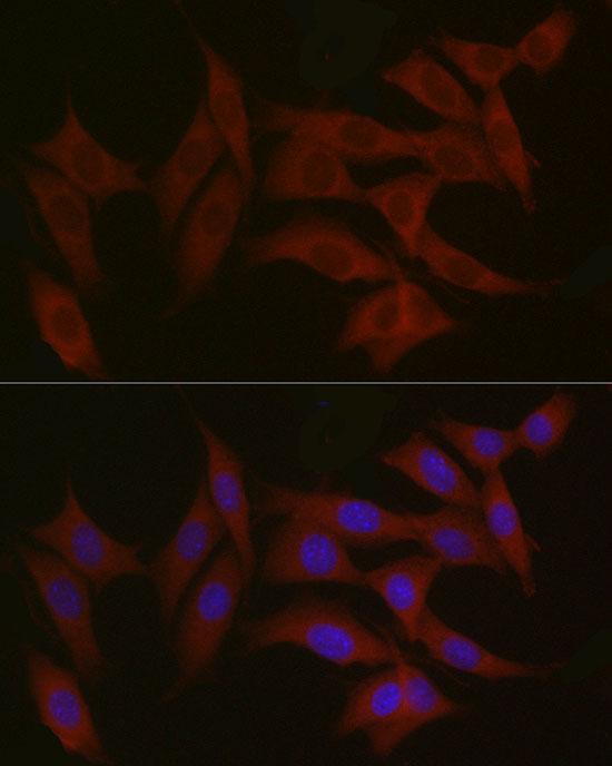 Anti-TYK2 Rabbit pAb