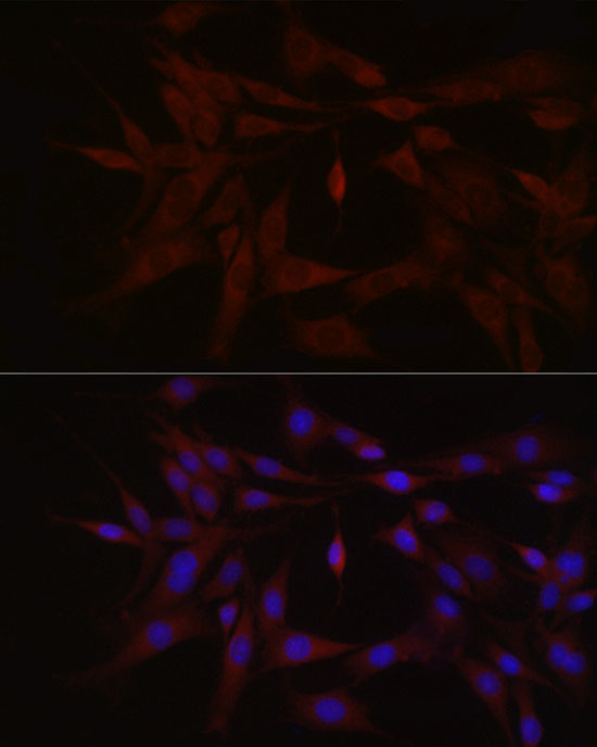 Anti-TYK2 Rabbit pAb