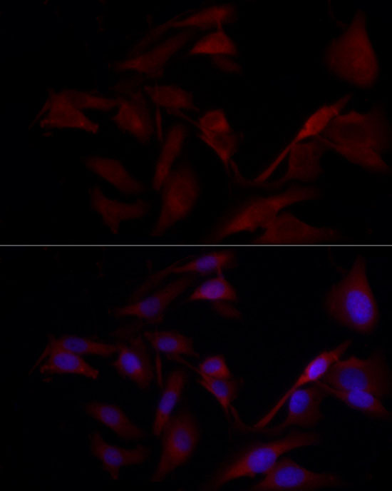 Anti-TYK2 Rabbit pAb