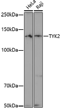 Anti-TYK2 Rabbit pAb