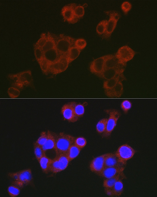 Anti-Complement factor H Rabbit pAb
