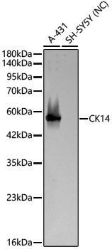 Anti-CK14 Rabbit pAb