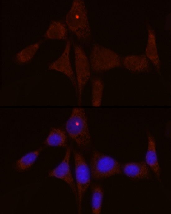 Anti-IL1RN Rabbit pAb