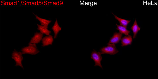 Anti-Smad1/5/9 Rabbit pAb