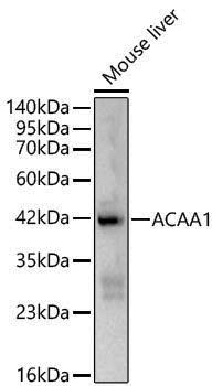 Anti-ACAA1 Rabbit pAb