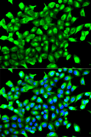 Anti-PHD2/EGLN1 Rabbit pAb