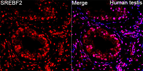 Anti-SREBF2 Rabbit pAb