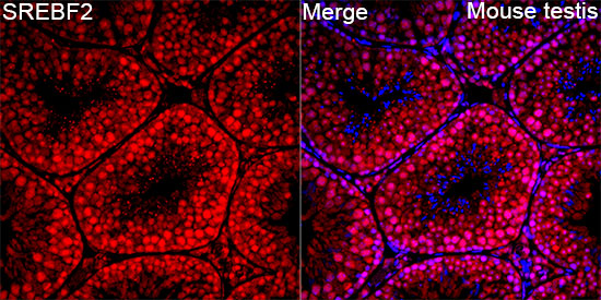 Anti-SREBF2 Rabbit pAb