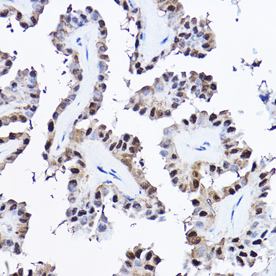 [KO Validated] Anti-PDCD4 Rabbit pAb