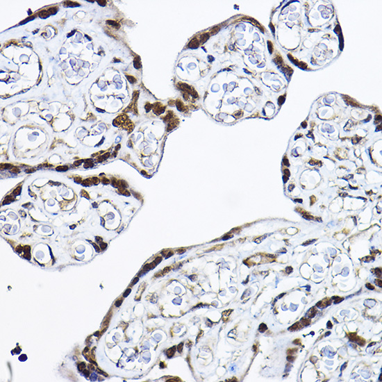 [KO Validated] Anti-PDCD4 Rabbit pAb