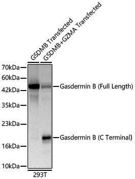 Anti-Gasdermin B (Full Length+C terminal) Rabbit pAb