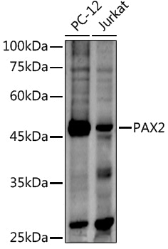 Anti-PAX2 Rabbit pAb