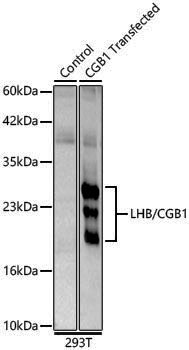 Anti-LHB/CGB1 Rabbit pAb