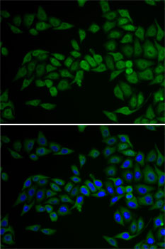 Anti-E2F6 Rabbit pAb