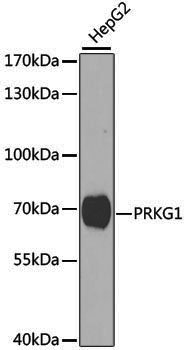 Anti-PRKG1 Rabbit pAb