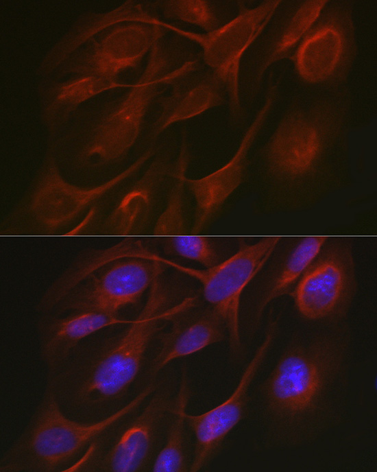 Anti-TRAF7 Rabbit pAb