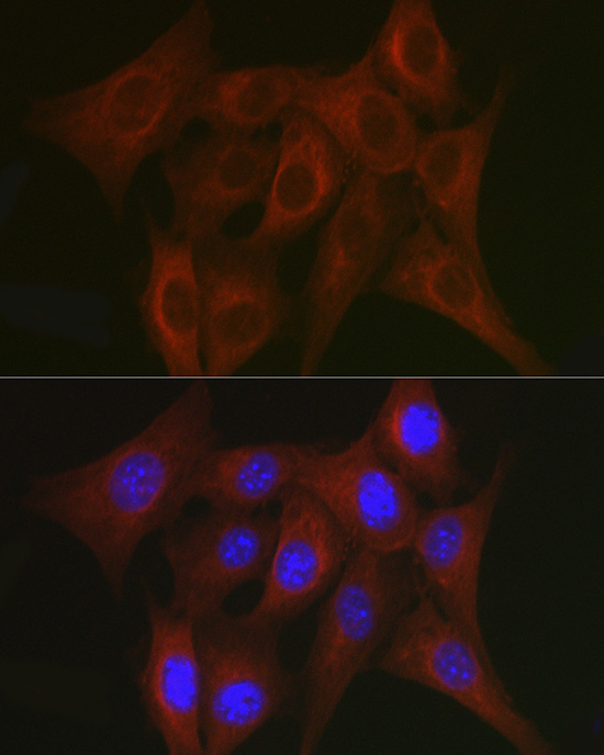 Anti-TRAF7 Rabbit pAb