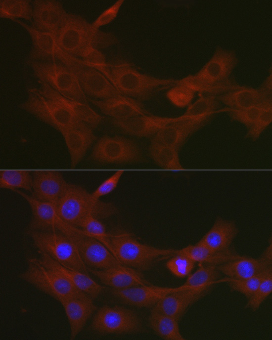 Anti-TRAF7 Rabbit pAb