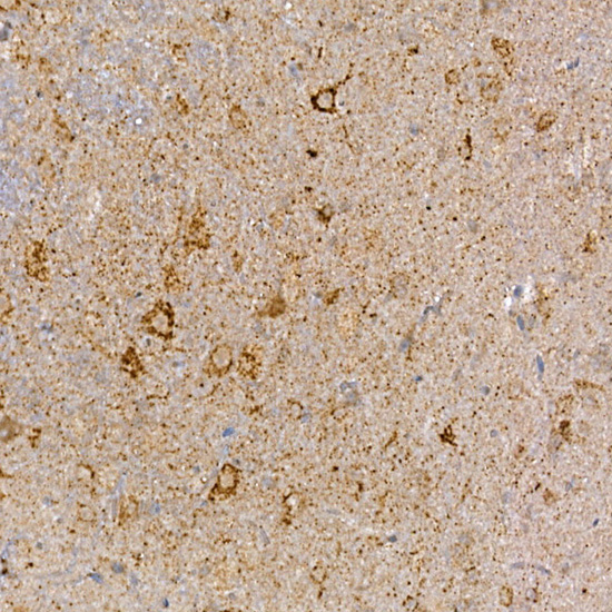 Anti-DVL3 Rabbit pAb
