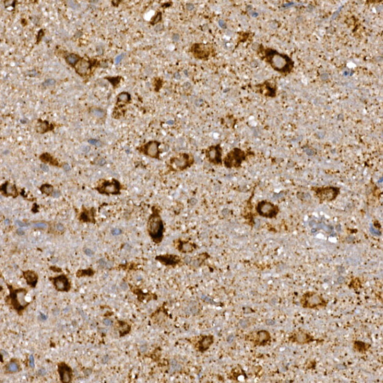 Anti-DVL3 Rabbit pAb