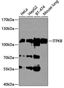 Anti-ITPKB Rabbit pAb