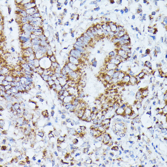 Anti-PP2A Catalytic Beta Rabbit pAb