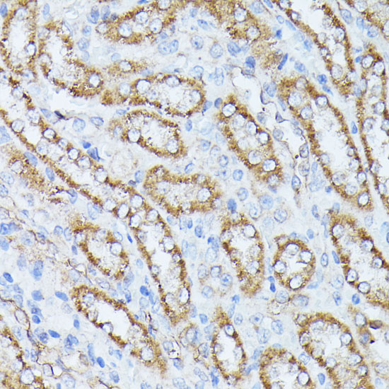 Anti-PP2A Catalytic Beta Rabbit pAb