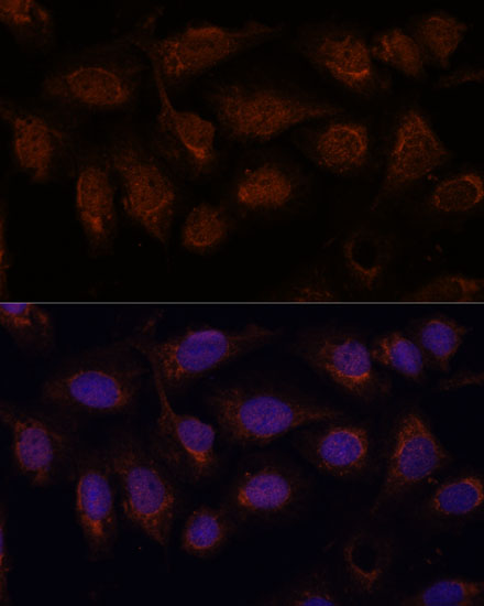 Anti-PP2A Catalytic Beta Rabbit pAb