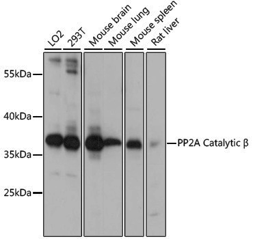 Anti-PP2A Catalytic Beta Rabbit pAb