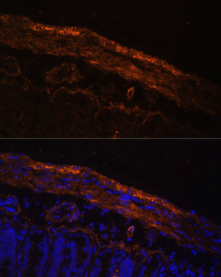 Anti-MYL9 Rabbit pAb
