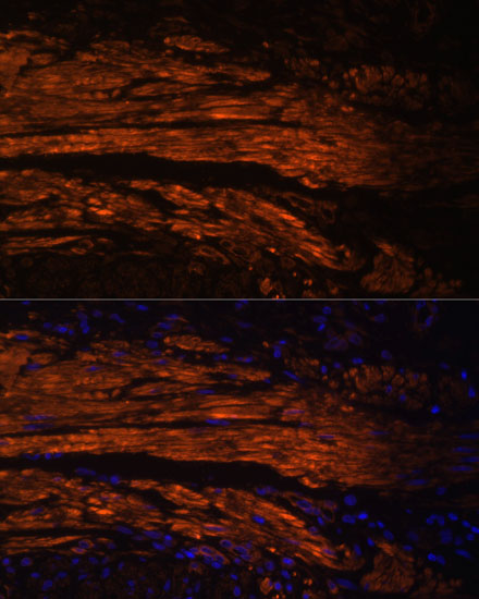 Anti-MYL9 Rabbit pAb
