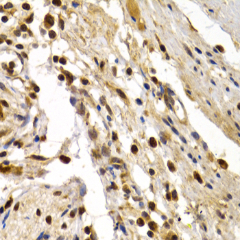 Anti-DP1/TFDP1 Rabbit pAb