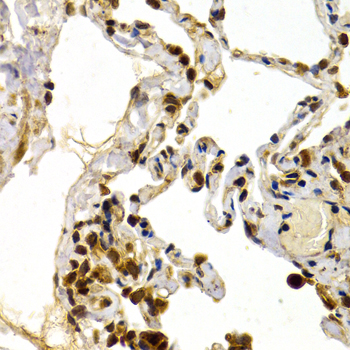 Anti-DP1/TFDP1 Rabbit pAb