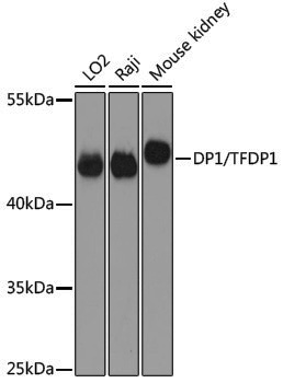 Anti-DP1/TFDP1 Rabbit pAb