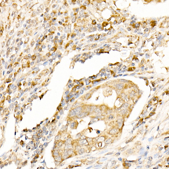 Anti-LC3A/B Rabbit pAb