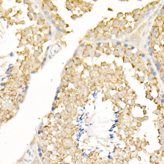 Anti-LC3A/B Rabbit pAb