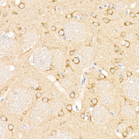Anti-LC3A/B Rabbit pAb