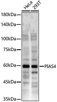Anti-PIAS4 Rabbit pAb