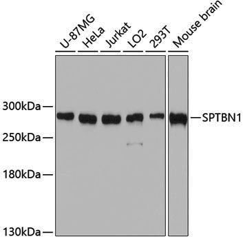Anti-SPTBN1 Rabbit pAb