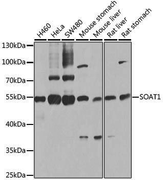 Anti-SOAT1 Rabbit pAb
